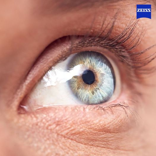 zeiss ottico pirri